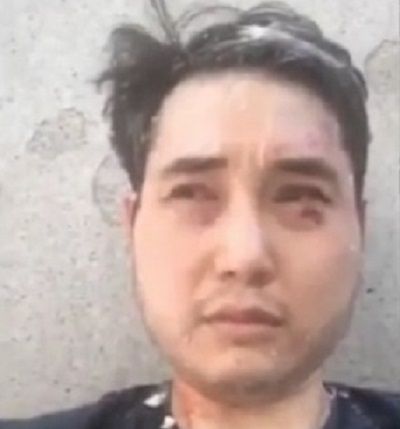Andy Ngo recently attacked by the Antifa rebels at Portland Proud Boys protest