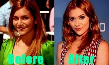 Alyson Stoner Height, Weight, Age, Boyfriend, Biography, Family, More 6 Alyson before and after plastic surgery