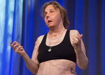 Carmen Tarleton American Former Nurse, Advocate, Author, Musician, and Motivational Speaker