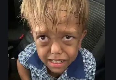 Quaden Bayles Height, Weight, Age, Biography, Family & More 2 Quaden Bayles' video went viral on the internet in order to show the impact of bullying