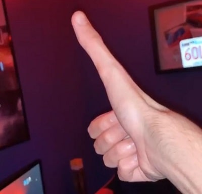 Jacob Pina's thumb went viral on the internet