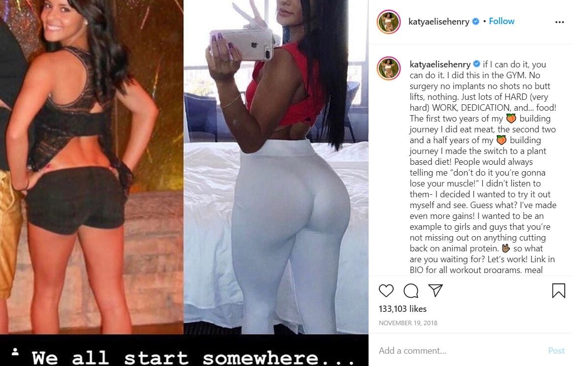 Katya Elise Henry Wiki, Age, Height, Weight, Family, Biography & Facts 18 Katya Elise Henry before and after