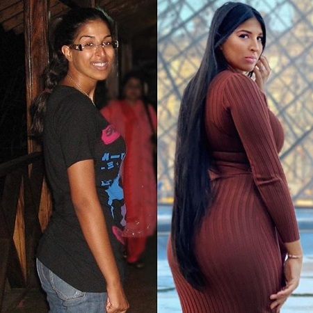 Farah Dhukai Wiki, Age, Husband, Height, Family, Biography & More 15 Farah Dhukai's body transformation (Plastic Surgery)