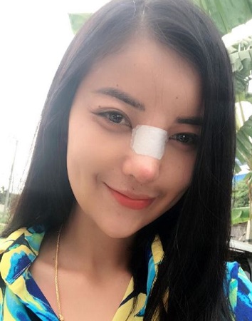 Faii Orapun Wiki, Height, Age, Boyfriend, Family, Biography & More 5 Faii Orapun nose surgery
