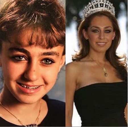 Shally Zomorodi won Miss California USA