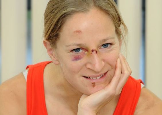 Who is Joasia Zakrzewski? Biography, Wiki, Height, Age, Height, Boyfriend, Family & More 11 Joasia Zakrzewski injury
