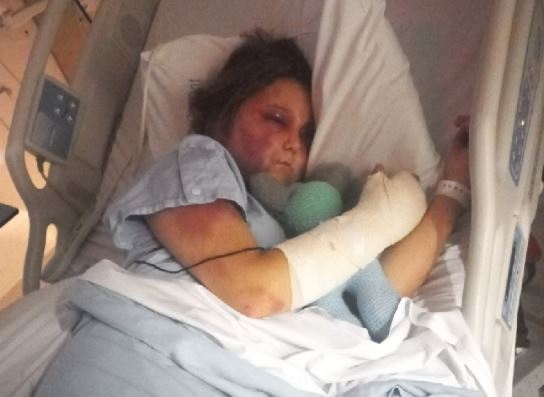 Kirra Hart injuries