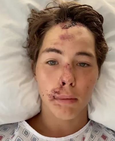 Caleb Coffee Age, Parents, Siblings, Wiki, Girlfriend, Height, Biography, Net Worth & More 8 Caleb Coffee hospitalized